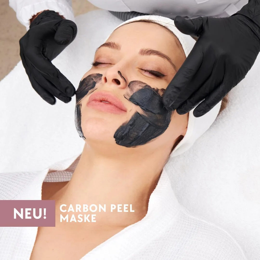 carbon peel maske